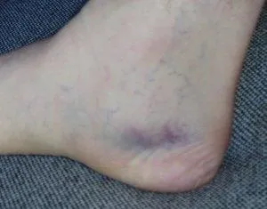 Inside of foot